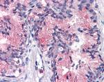 CD298 Antibody in Immunohistochemistry (Paraffin) (IHC (P))