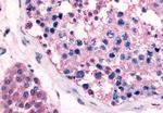 GPR18 Antibody in Immunohistochemistry (Paraffin) (IHC (P))