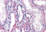 LPCAT1 Antibody in Immunohistochemistry (Paraffin) (IHC (P))