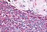 PTGES Antibody in Immunohistochemistry (Paraffin) (IHC (P))