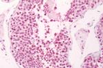 PTGES Antibody in Immunohistochemistry (Paraffin) (IHC (P))