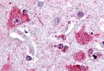 PTGES Antibody in Immunohistochemistry (Paraffin) (IHC (P))