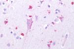 HTR1D Antibody in Immunohistochemistry (Paraffin) (IHC (P))