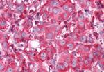 ADORA1 Antibody in Immunohistochemistry (Paraffin) (IHC (P))