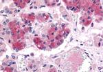 AVPR1B Antibody in Immunohistochemistry (Paraffin) (IHC (P))