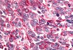 BAI2 Antibody in Immunohistochemistry (Paraffin) (IHC (P))