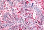 BAI2 Antibody in Immunohistochemistry (Paraffin) (IHC (P))