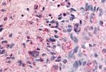 BAI2 Antibody in Immunohistochemistry (Paraffin) (IHC (P))