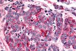 BAI2 Antibody in Immunohistochemistry (Paraffin) (IHC (P))