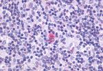 CXCR5 Antibody in Immunohistochemistry (Paraffin) (IHC (P))