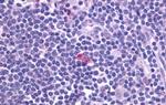 CXCR5 Antibody in Immunohistochemistry (Paraffin) (IHC (P))