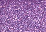 CXCR5 Antibody in Immunohistochemistry (Paraffin) (IHC (P))