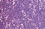 CXCR5 Antibody in Immunohistochemistry (Paraffin) (IHC (P))