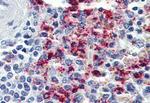 CYSLTR2 Antibody in Immunohistochemistry (Paraffin) (IHC (P))