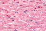 ELTD1 Antibody in Immunohistochemistry (Paraffin) (IHC (P))