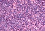 EMR2 Antibody in Immunohistochemistry (Paraffin) (IHC (P))