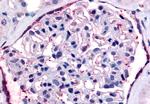 PAR2 Antibody in Immunohistochemistry (Paraffin) (IHC (P))