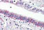 Protease-Activated Receptor-4 Antibody in Immunohistochemistry (Paraffin) (IHC (P))