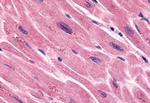 FZD7 Antibody in Immunohistochemistry (Paraffin) (IHC (P))