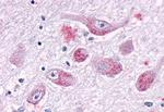 GALR1 Antibody in Immunohistochemistry (Paraffin) (IHC (P))