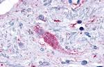 GPR116 Antibody in Immunohistochemistry (Paraffin) (IHC (P))