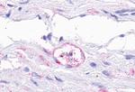 TEM5 Antibody in Immunohistochemistry (Paraffin) (IHC (P))