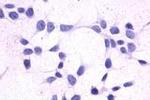 CRTH2 Antibody in Immunocytochemistry (ICC/IF)