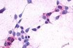 CRTH2 Antibody in Immunocytochemistry (ICC/IF)