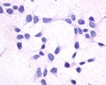 CRTH2 Antibody in Immunocytochemistry (ICC/IF)