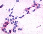 CRTH2 Antibody in Immunocytochemistry (ICC/IF)