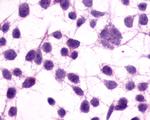 mGluR3 Antibody in Immunocytochemistry (ICC/IF)