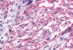 mGluR3 Antibody in Immunohistochemistry (Paraffin) (IHC (P))