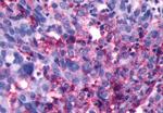 LHR Antibody in Immunohistochemistry (Paraffin) (IHC (P))