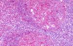 KISS1R Antibody in Immunohistochemistry (Paraffin) (IHC (P))