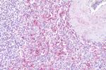 LTB4R Antibody in Immunohistochemistry (Paraffin) (IHC (P))