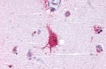 LGR6 Antibody in Immunohistochemistry (Paraffin) (IHC (P))