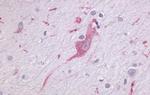 LPHN1 Antibody in Immunohistochemistry (Paraffin) (IHC (P))