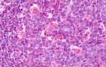 LPHN3 Antibody in Immunohistochemistry (Paraffin) (IHC (P))