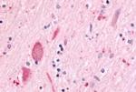 MINK1 Antibody in Immunohistochemistry (Paraffin) (IHC (P))