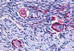 NR4A1 Antibody in Immunohistochemistry (Paraffin) (IHC (P))