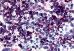 P2Y12 Antibody in Immunohistochemistry (Paraffin) (IHC (P))