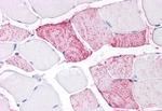 PTPRA Antibody in Immunohistochemistry (Paraffin) (IHC (P))