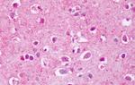 PTPRA Antibody in Immunohistochemistry (Paraffin) (IHC (P))