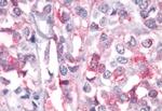 PTPRA Antibody in Immunohistochemistry (Paraffin) (IHC (P))