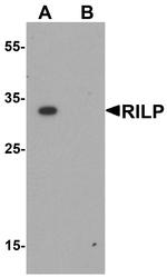 RILP Antibody in Western Blot (WB)