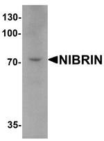 NBS1 Antibody in Western Blot (WB)