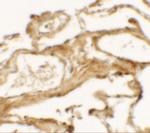 NBS1 Antibody in Immunohistochemistry (IHC)