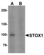 STOX1 Antibody in Western Blot (WB)