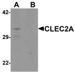 CLEC2A Antibody in Western Blot (WB)