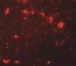 CBX4 Antibody in Immunohistochemistry (IHC)